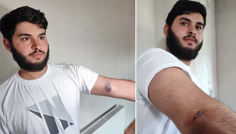 Bahçeye Kaçan Top, Mahallede Büyük Karışıklık Yarattı